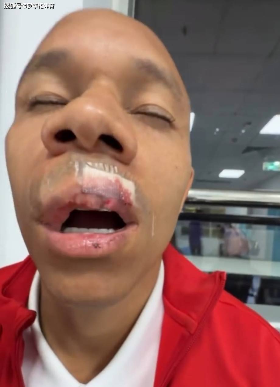 โหดร้ายเกินไป! แฟนบอลยังคิดว่าใบแดงของเจียงจื่อเป็งผิดไหม? บรรยายสรุปอย่างเป็นทางการ: ซิลวาถูกทุบตีและแตกหัก