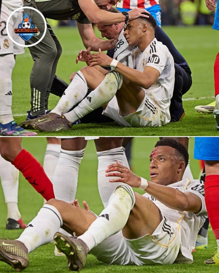 เอ็มบัปเป้ถูกตีด้วยเลือดในเขตโทษและโค้ชเรอัล มาดริด: บนดวงจันทร์ - ผู้ตัดสิน_Avalo_Alex